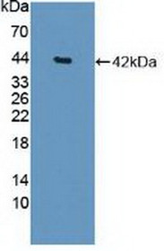 Western Blot; Sample: Recombinant HDAC9, Human.