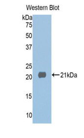 Western Blot; Sample: Recombinant protein.
