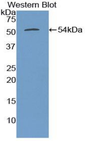 Western Blot; Sample: Recombinant protein.
