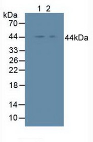 Western Blot; Sample: Lane1: Human Hela Cells; Lane2: Human A375 Cells.