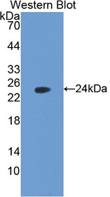 Western Blot; Sample: Recombinant protein.