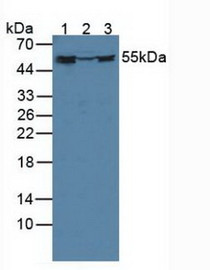 Western Blot; Sample: Lane1: Human K562 Cells; Lane2: Porcine Brain Tissue; Lane3: Porcine Kidney Tissue.