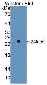 Western Blot; Sample: Recombinant protein.