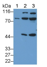 Western Blot; Sample: Recombinant RIPK1, Human.