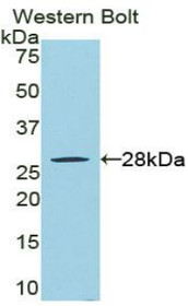 Western Blot; Sample: Recombinant protein.