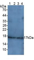Western Blot; Sample: Lane1: Rat Brain Tissue; Lane2: Human Liver Tissue; Lane3: Human Hela Cells; Lane4: Rat Uterus Tissue.