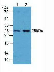Western Blot; Sample: Lane1: Human Liver Tissue; Lane2: Human Lung Tissue.