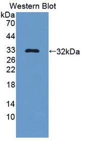 Western Blot; Sample: Recombinant Bcl11A, Human.