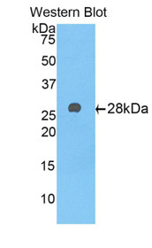 Western Blot; Sample: Recombinant protein.