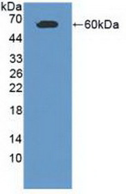 Western Blot; Sample: Recombinant CADM1, Human.