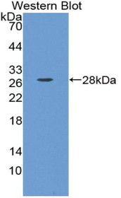 Western Blot; Sample: Recombinant protein.