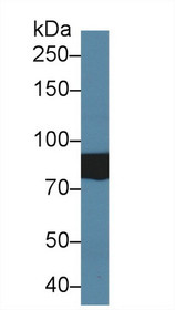 Western Blot; Sample: Human Serum; Primary Ab: 2µg/ml Rabbit Anti-Human TAT1 Antibody Second Ab: 0.2µg/mL HRP-Linked Caprine Anti-Rabbit IgG Polyclonal Antibody
