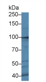 Western Blot; Sample: Human Hela cell lysate; Primary Ab: 1µg/ml Rabbit Anti-Human ROR2 Antibody Second Ab: 0.2µg/mL HRP-Linked Caprine Anti-Rabbit IgG Polyclonal Antibody