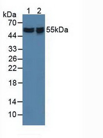Western Blot; Sample: Lane1: Human Hela Cells; Lane2: Human 293T Cells.