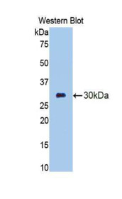 Western Blot; Sample: Recombinant protein.