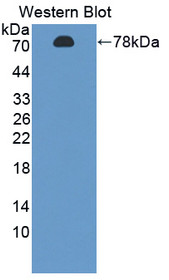 Western Blot; Sample: Recombinant protein.