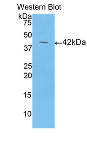 Western Blot; Sample: Recombinant protein.
