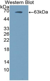 Western Blot; Sample: Recombinant protein.
