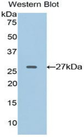 Western Blot; Sample: Recombinant protein.