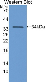 Western Blot; Sample: Recombinant protein.