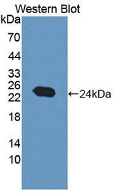 Western Blot; Sample: Recombinant protein.