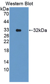 Western Blot; Sample: Recombinant protein.