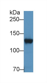 Western Blot; Sample: Rat Cerebrum lysate; Primary Ab: 2µg/ml Rabbit Anti-Human DPP6 Antibody Second Ab: 0.2µg/mL HRP-Linked Caprine Anti-Rabbit IgG Polyclonal Antibody