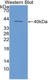 Western Blot; Sample: Recombinant protein.