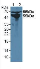 Western Blot; Sample: Lane1: Rat Liver Tissue; Lane2: Rat Kidney Tissue.