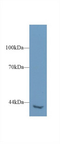 Western Blot; Sample: Mouse Kidney lysate; Primary Ab: 1µg/ml Rabbit Anti-Human PLCh2 Antibody Second Ab: 0.2µg/mL HRP-Linked Caprine Anti-Rabbit IgG Polyclonal Antibody