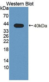 Western Blot; Sample: Recombinant protein.