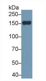 Western Blot; Sample: Rat Serum; Primary Ab: 2µg/ml Rabbit Anti-Rat PLCb2 Antibody Second Ab: 0.2µg/mL HRP-Linked Caprine Anti-Rabbit IgG Polyclonal Antibody