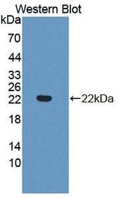 Western Blot; Sample: Recombinant protein.