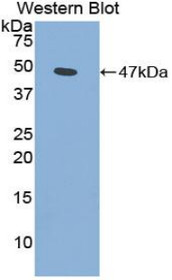 Western Blot; Sample: Recombinant protein.