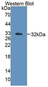 Western Blot; Sample: Recombinant protein.