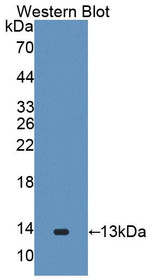 Western Blot; Sample: Recombinant protein.