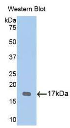 Western Blot; Sample: Recombinant protein.