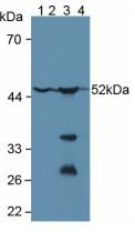 Western Blot; Sample: Lane1: Human Liver Tissue; Lane2: Mouse Brain Tissue; Lane3: Mouse Kidney Tissue; Lane3: Rat Spleen Tissue.