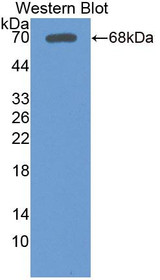 Western Blot; Sample: Recombinant protein.