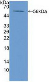 Western Blot; Sample: Recombinant ABCA13, Mouse.