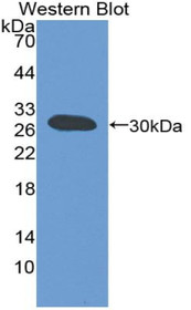 Western Blot; Sample: Recombinant protein.
