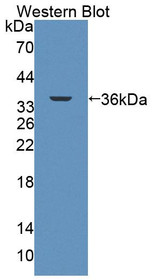 Western Blot; Sample: Recombinant protein.