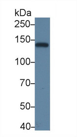 Western Blot; Sample: Recombinant protein.