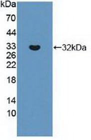 Western Blot; Sample: Recombinant ABCC8, Human.