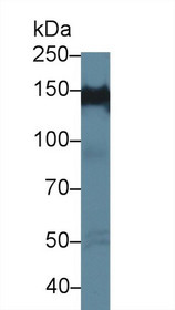 Western Blot; Sample: Human Hela cell lysate; Primary Ab: 1µg/ml Rabbit Anti-Human PPFIA1 Antibody Second Ab: 0.2µg/mL HRP-Linked Caprine Anti-Rabbit IgG Polyclonal Antibody