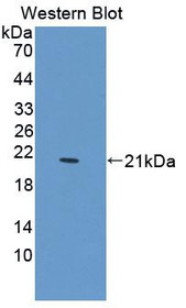 Western Blot; Sample: Recombinant protein.