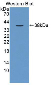 Western Blot; Sample: Recombinant protein.