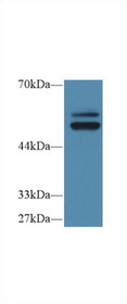 Western Blot; Sample: Human HL60 cell lysate; Primary Ab: 1µg/ml Rabbit Anti-Human PTPN5 Antibody Second Ab: 0.2µg/mL HRP-Linked Caprine Anti-Rabbit IgG Polyclonal Antibody