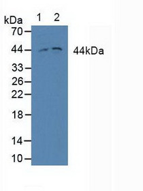 Western Blot; Sample: Lane1: Human Jurkat cells; Lane2: Human Hela cels.