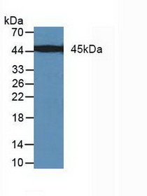 Western Blot; Sample: Human Jar cells.